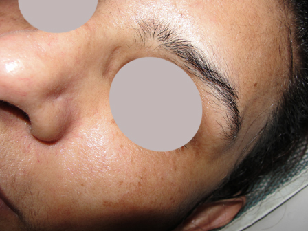 Dr Pandya Clinic Udaipur
